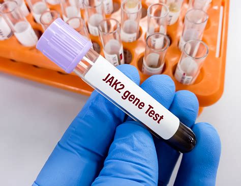 jak 2 blood test bottle|what is the jak2 gene called.